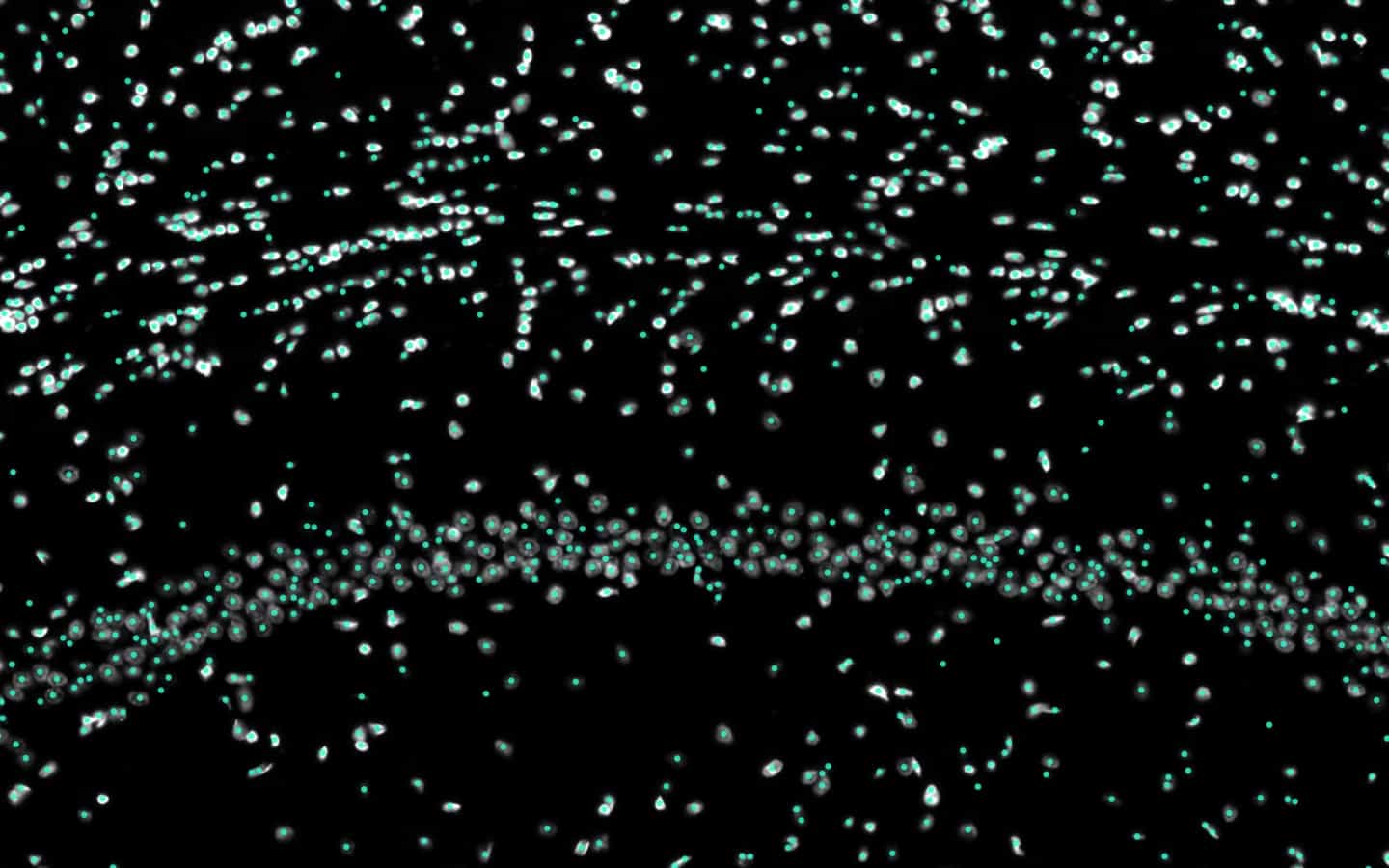 Detailed rat brain tissue view with NeuroQP cell detections