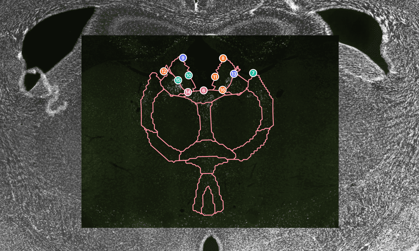 20x staining aligned to registered 4x atlas reference