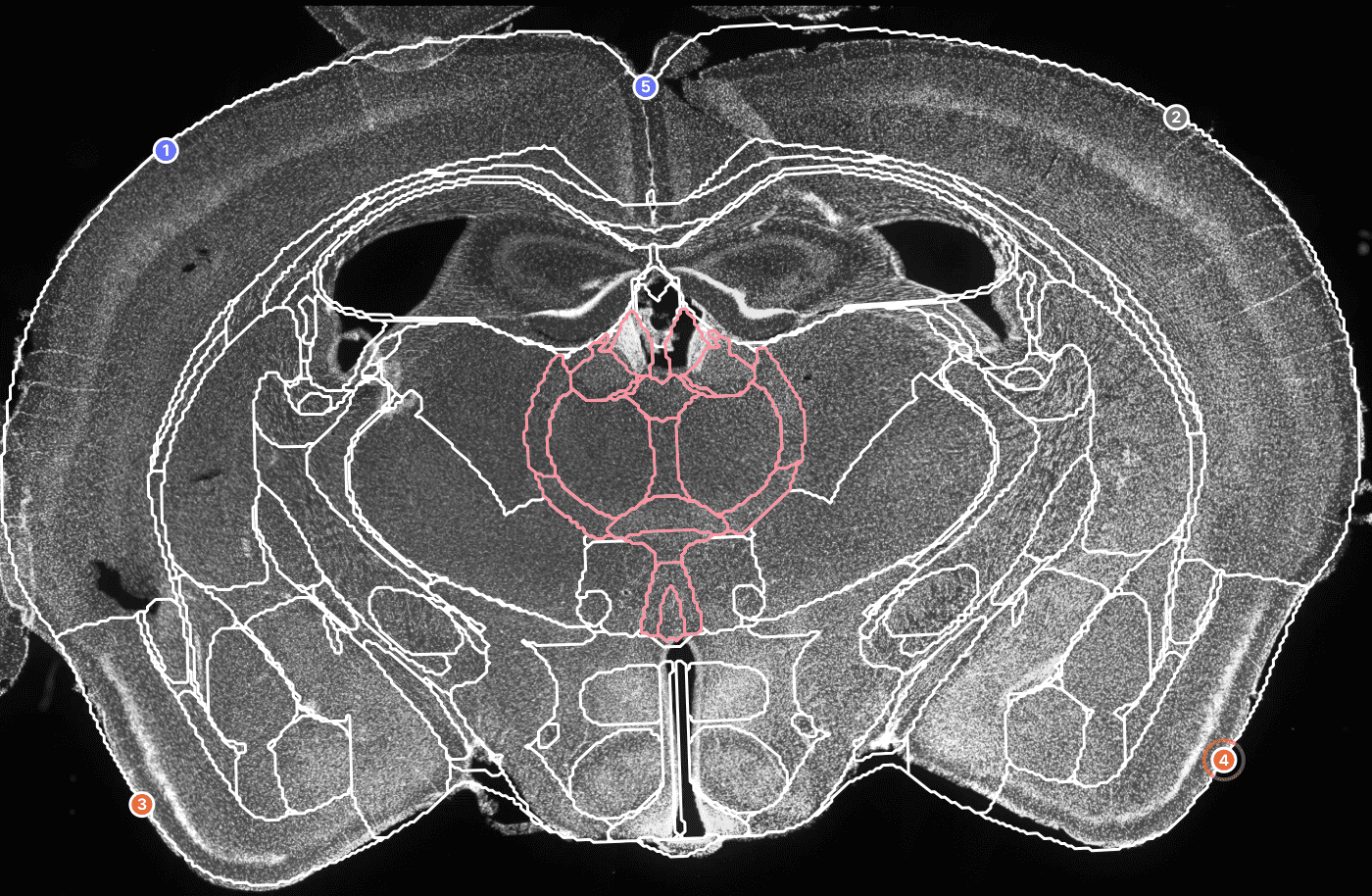 Whole 4x mouse brain slice with atlas overlay