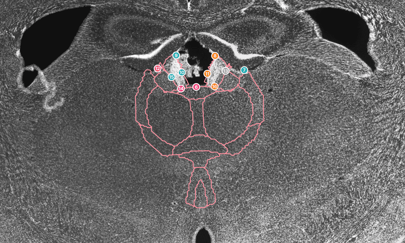 Zoomed atlas registration points on a mouse brain slice