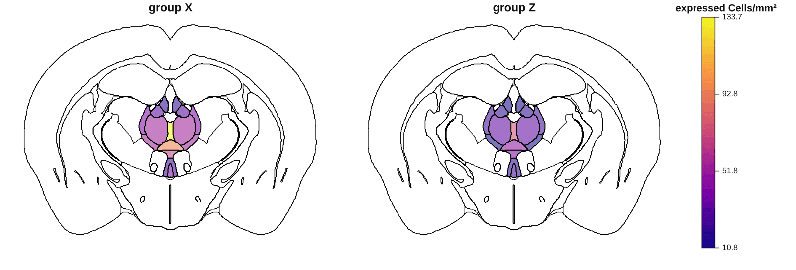 Anatomical plot with brain region results