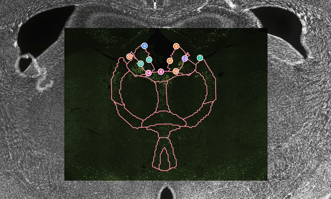 20x staining aligned to registered 4x atlas reference