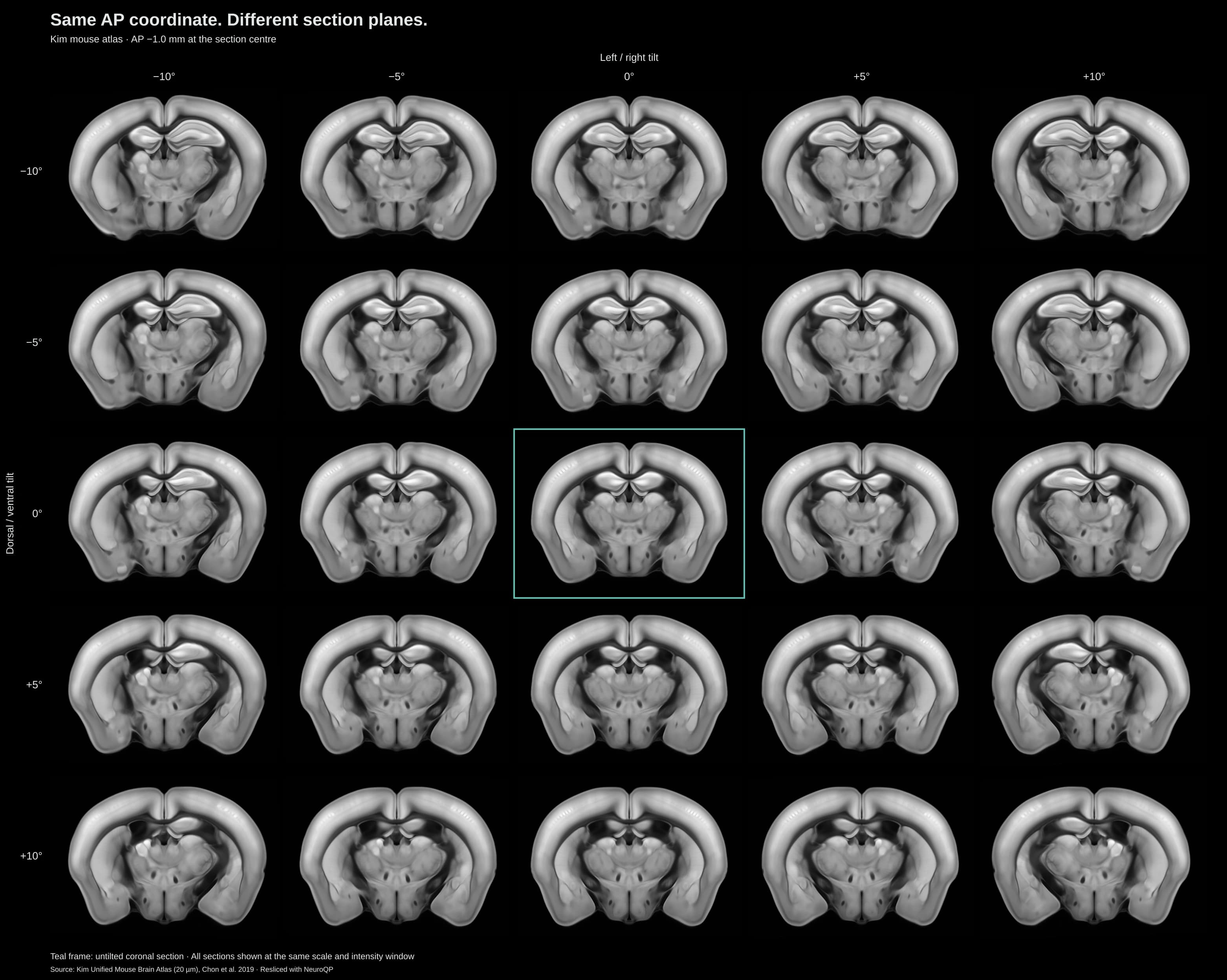 Twenty-five Kim mouse atlas sections at AP −1.0 mm with left/right and dorsal/ventral tilts from −10° to +10°.