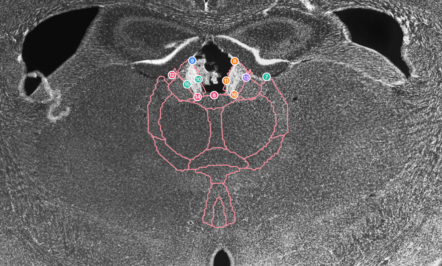 Zoomed atlas registration points on a mouse brain slice