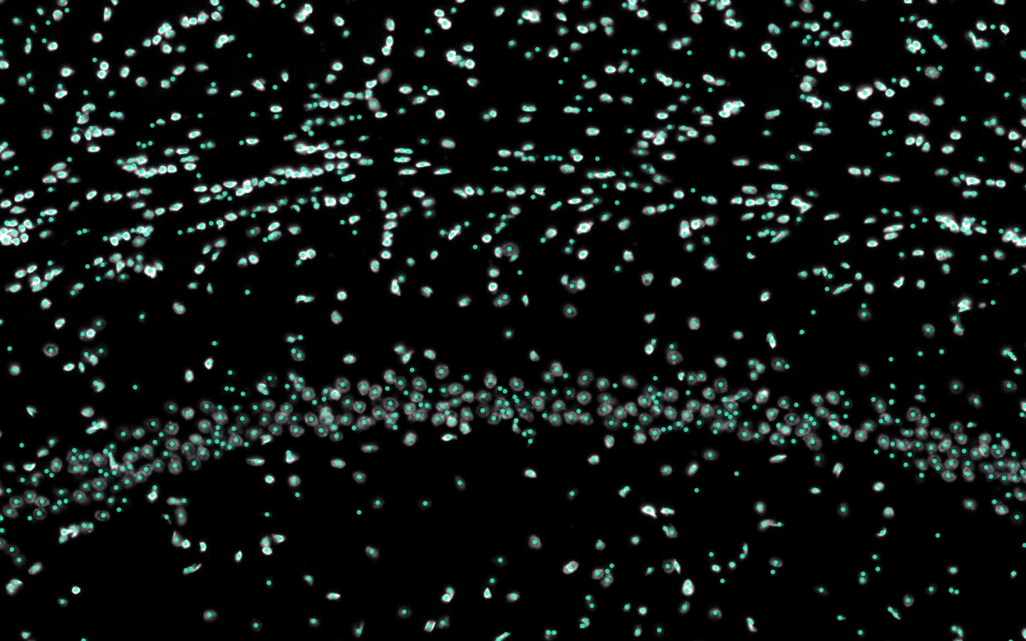 Detailed rat brain tissue view with NeuroQP cell detections