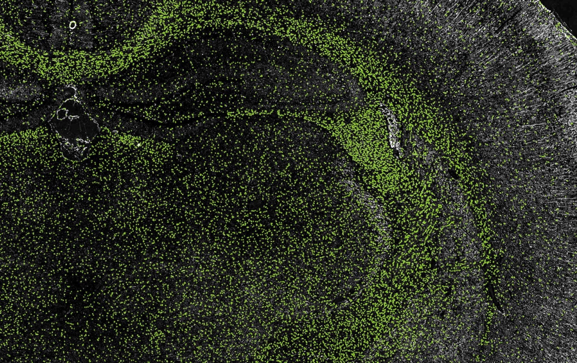 Rat brain tissue with NeuroQP cell classification overlay