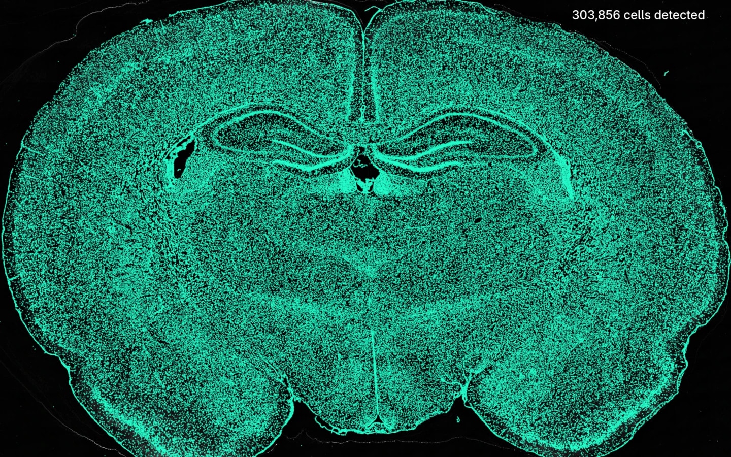 Whole rat brain section with NeuroQP cell detections