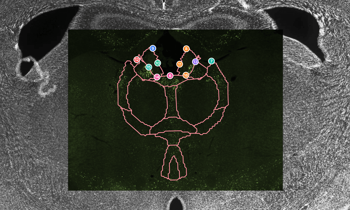 20x staining aligned to registered 4x atlas reference