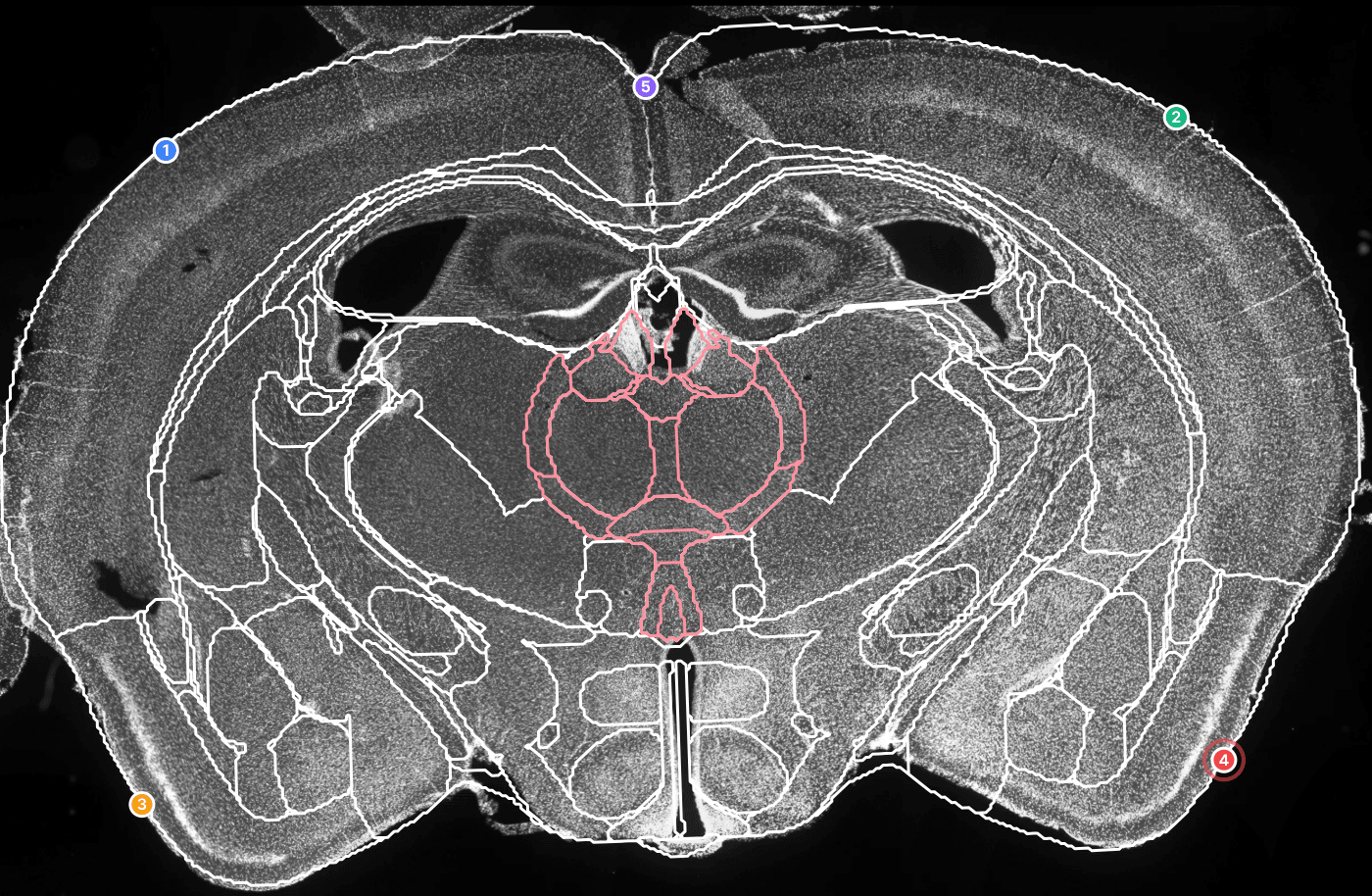 Whole 4x mouse brain slice with atlas overlay