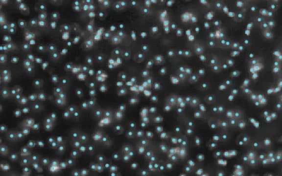 Detected cells marked in cyan on a microscopy image