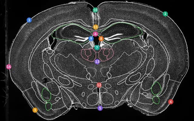 Brain atlas outlines fitted to a microscopy image