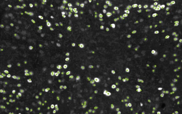 Microscopy image with detected cells marked in green