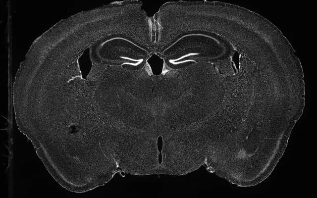 Grayscale coronal mouse brain section